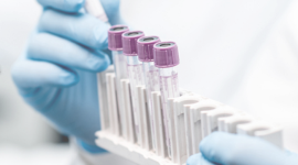 Divisi R&D CHEK menjadi tulang punggung inovasi produk diagnostik yang memperkuat margin laba perusahaan. (Dok. diastika.co.id)